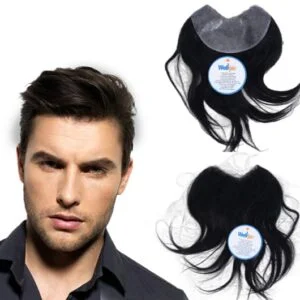 Front Line Hair Patch Hair Line