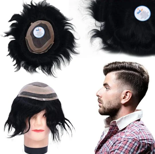 Front Line Hair Patch ₹12,999.0